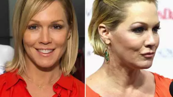 La actriz, conocida por la serie Beverly Hills 90210, desató rumores de haberse practicado botox o, incluso, de haberse realizado una cirugía estética para restirarsela.