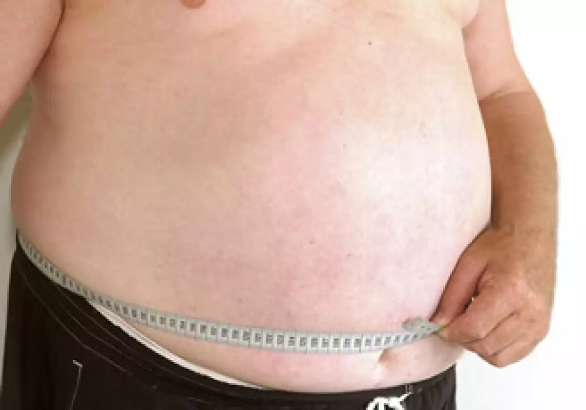 Las personas que sufren obesidad pueden desarrollar otras enfermedades como diabetes, daño renal, enfermedades del corazón, accidentes cerebrovasculares, entre otras. (Foto: Photos to Go)