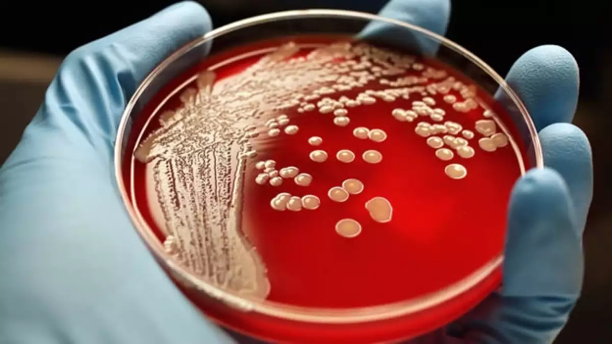laboratorio, ciencia, enfermedad, virus, infeccion, medico, analisis,