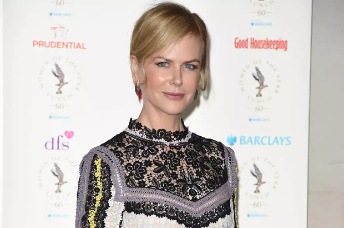 Nicole sufrió graves lesiones durante la filmación de Moulin Rouge, además de que en esa fecha acababa de separarse de Brad Pitt.