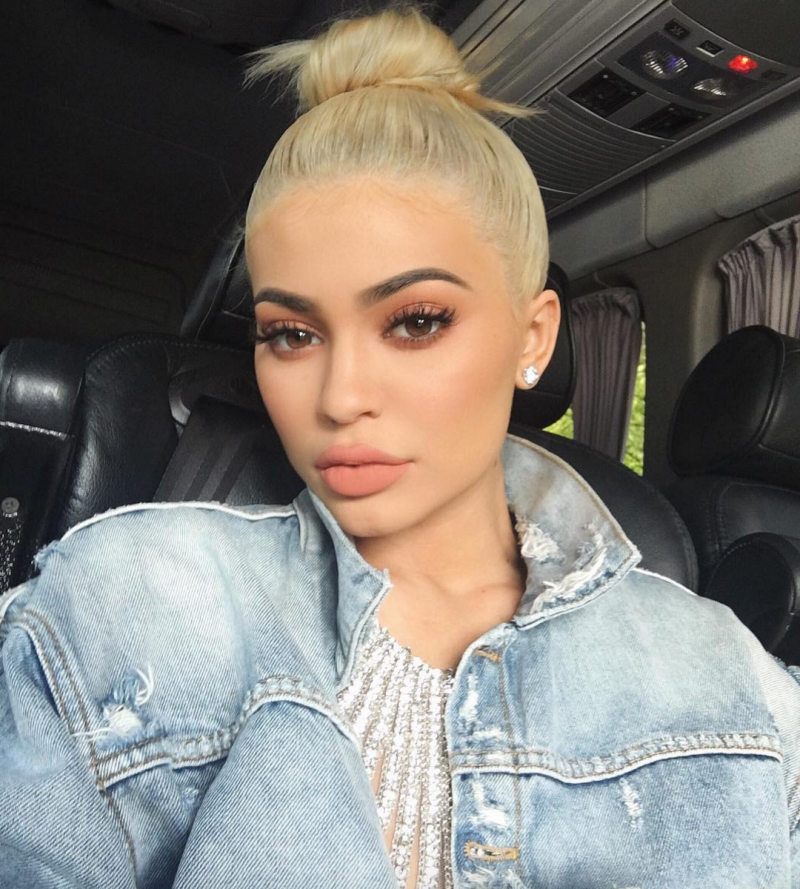 Kylie Jenner y sus big lips