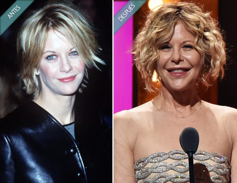 Estos famosos se han hecho cirugías plásticas que más que corregir algún rasgo, los han transformado en una persona completamente distinta. ¿De quiénes te hablamos?