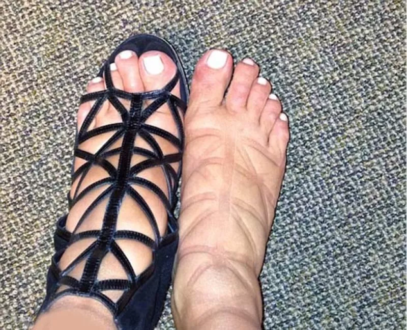 La estrella de reality show confesó que debido a que sus pies se han hinchado, se ha visto en la necesidad de comprar tallas más grandes pero ¿qué pasa cuando los forza?