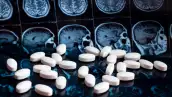 ¿Una nueva esperanza contra el Alzheimer? Novo Nordisk estudia conexión con medicamentos para la diabetes