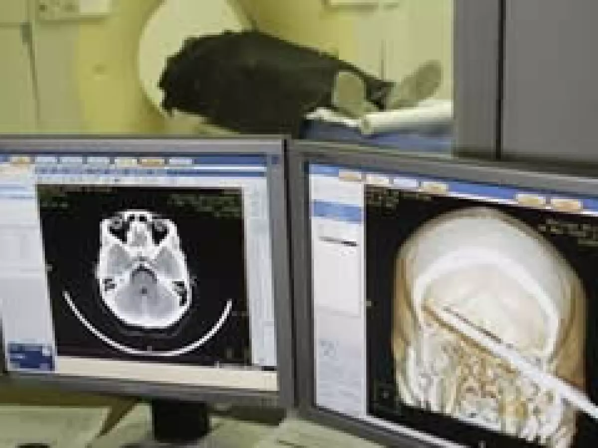 La degradación del cerebro es el culpable de la pérdida de memoria a largo y corto plazo. (Foto: AP )