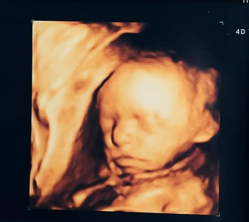 La actriz quiso compartir con sus seguidores en Instagram la primera imagen de su segunda hija, a quien esperan para julio.