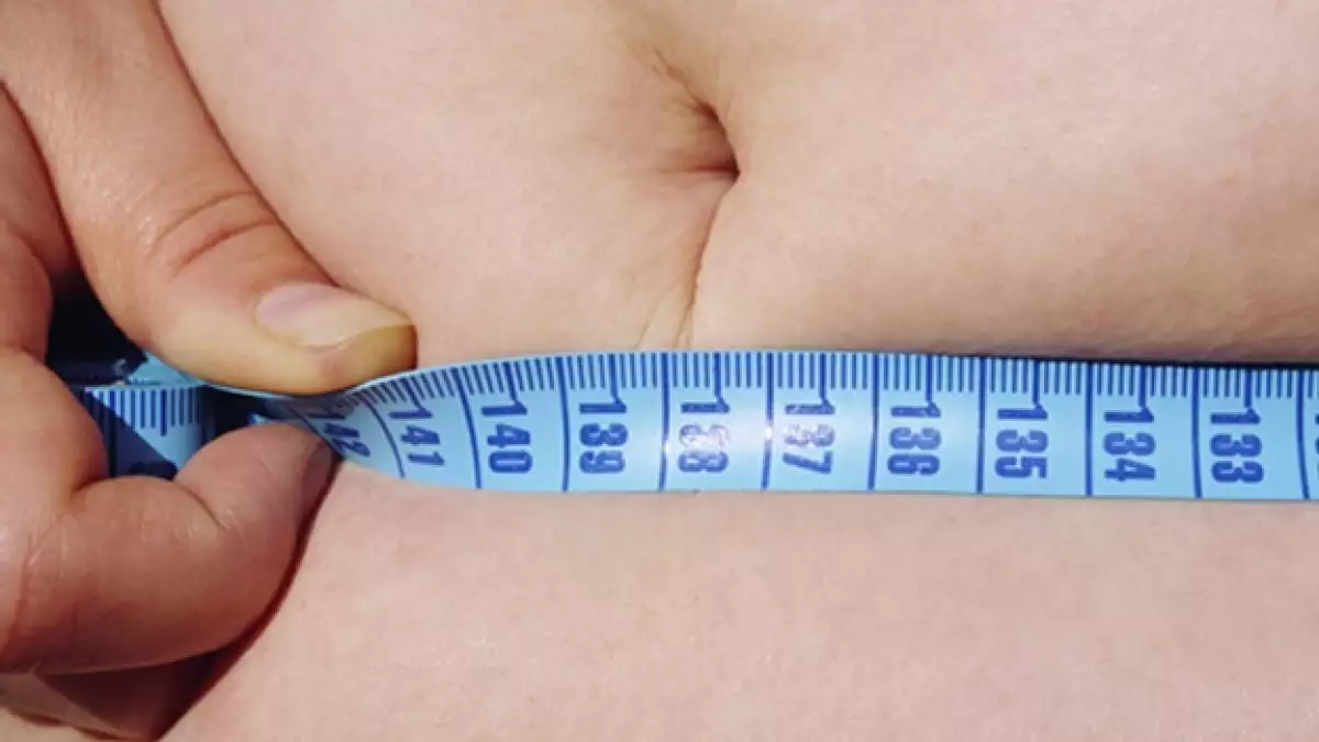 obese gordo