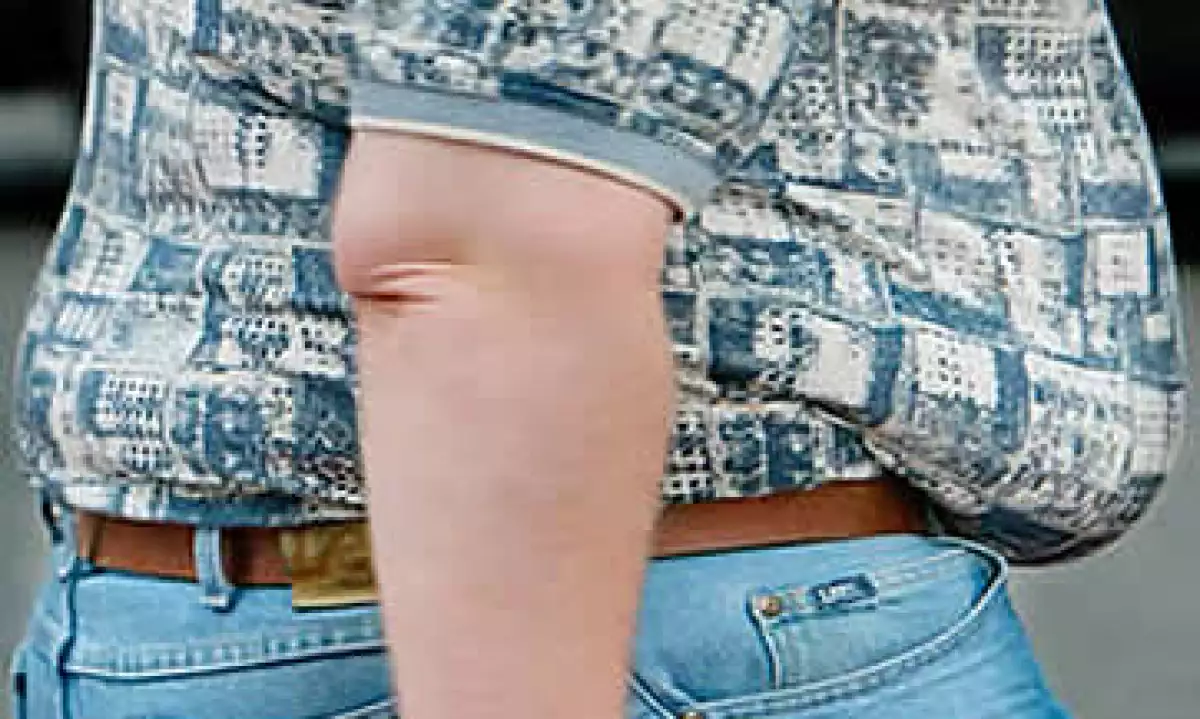 Obesidad (Foto: AP)