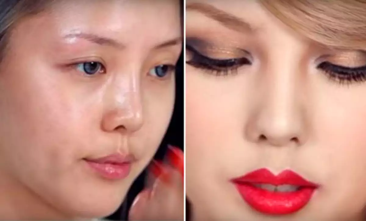 El antes y después de Park.