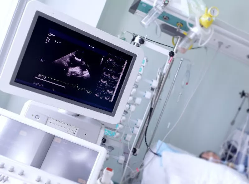 aparato de ultrasonido