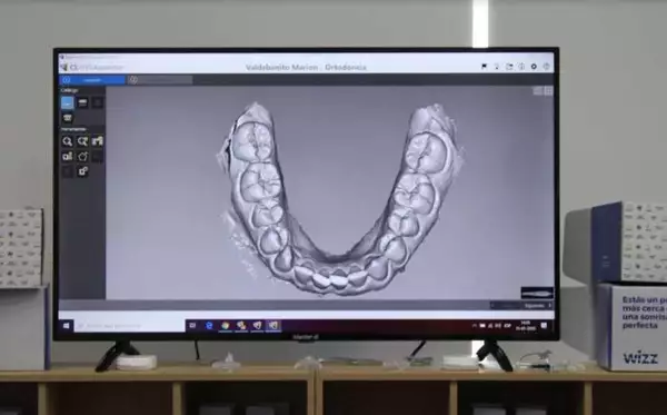 tecnología ortodoncia 
