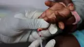 Una enfermera toma una muestra de sangre de un niño para una prueba de VIH en una clínica en Diepsloot, al norte de Johannesburgo, Sudáfrica, 12 de marzo de 2025. (Imagen principal del artículo web "Recortes de ayuda de EU agravan crisis del VIH en Sudáfrica: caen pruebas y seguimiento médico"). 