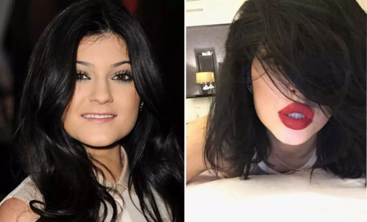 Desde Kylie Jenner hasta Renée Zellweger, hay famosas que pese a lo diferentes que se ven han negado haberse hecho cambios estéticos.