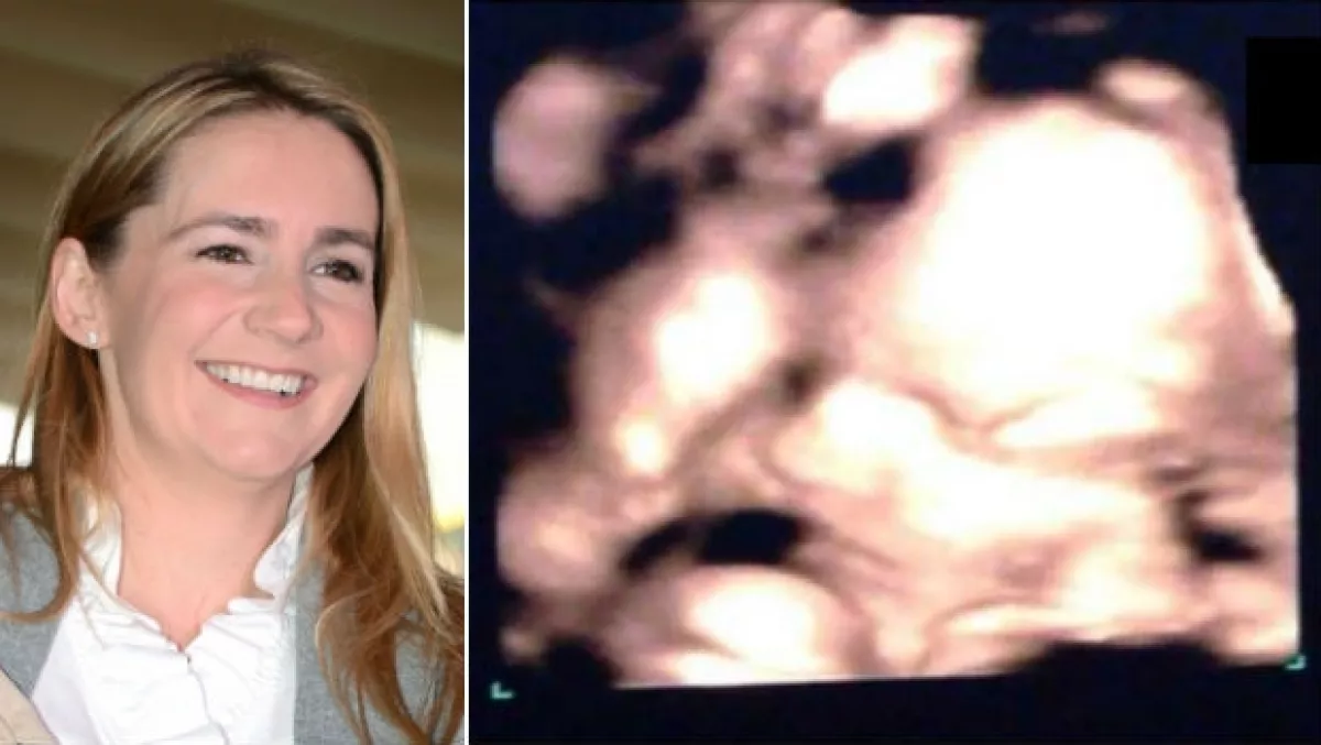 Maggie compartió esta foto del ultrasonido de su bebé.