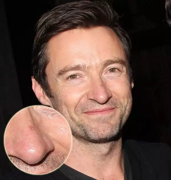 Este 13 de noviembre lo vimos en Nueva York y aún tenía la marca.