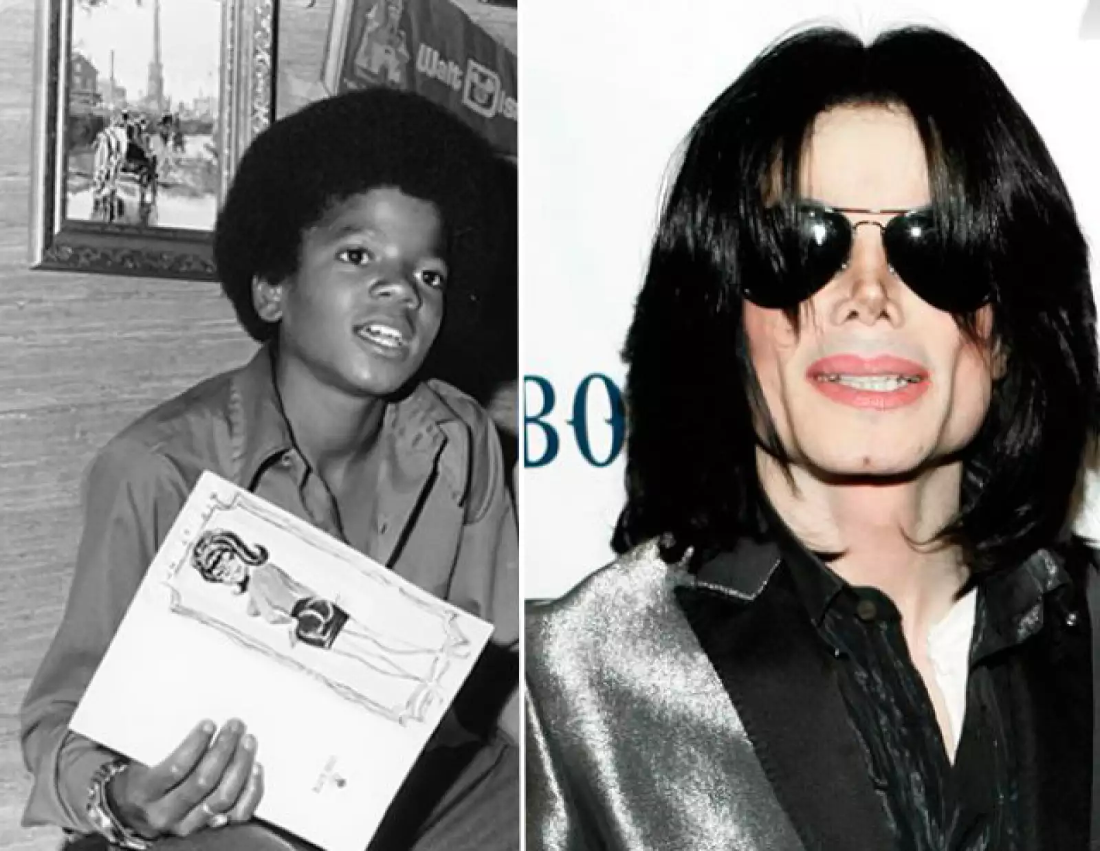 Michael Jackson es el mejor ejemplo de una transformación. El doctor Wallace Goodstein, quien lo asistió durante los 90, aseguró que entraba a la clínica una vez cada dos meses y se hizo entre 10 y 12 cirugías solo en el tiempo que él estuvo allí.