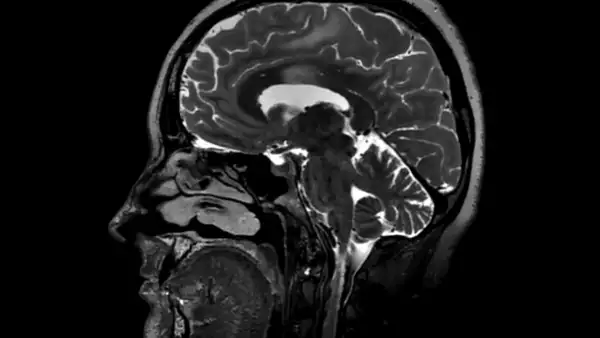 Los adolescentes de 30 años son una realidad, la Universidad de Cambridge revela las edades del cerebro
