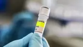 Este folleto publicado por el Ministerio de Salud de Argentina muestra a un científico del Instituto Malbr·n sosteniendo un contenedor utilizado para diagnosticar el hantavirus de los Andes, que contiene ARN del virus de los Andes como parte del proceso de detección, en Buenos Aires el 6 de mayo de 2026. Argentina ha visto un aumento en los casos de hantavirus, pero no un brote, dijo un experto a la AFP el 6 de mayo, ya que las infecciones a bordo de un crucero han provocado un susto de salud mundial.