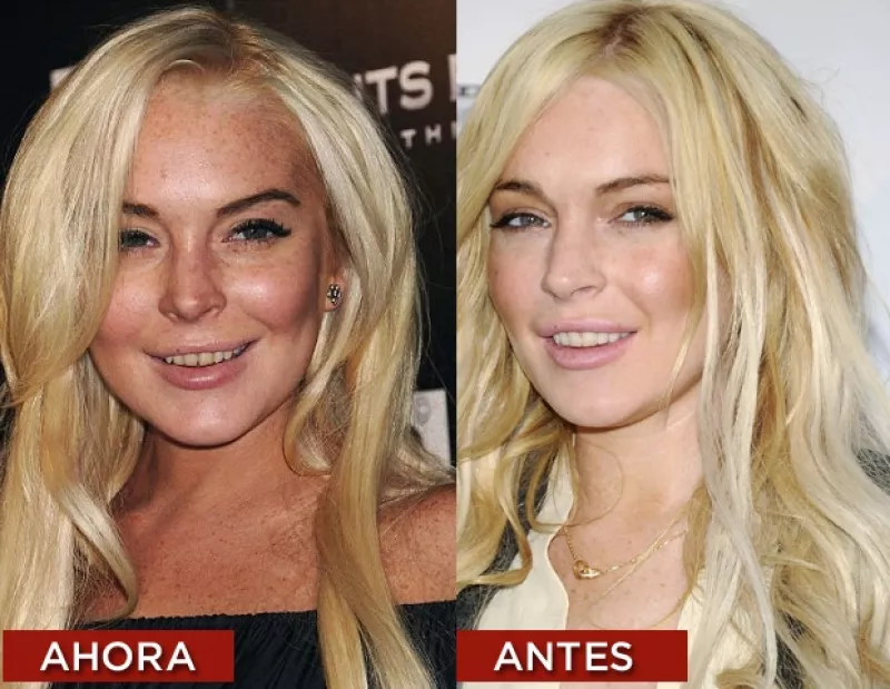 La joven actriz apareció en la alfombra roja y sorprendió por su apariencia, ya que sus dientes lucían muy amarillos por su adicción al tabaco