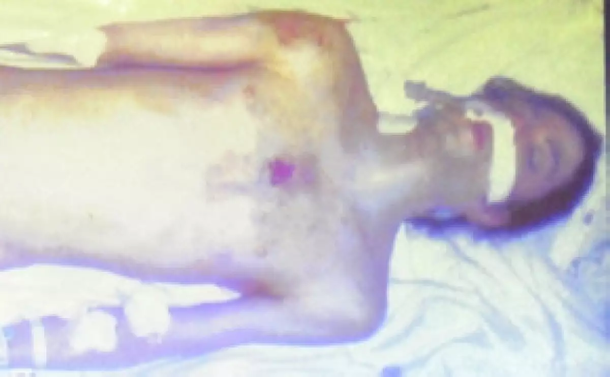 Así lucía el cuerpo de Michael Jackson horas después de morir.