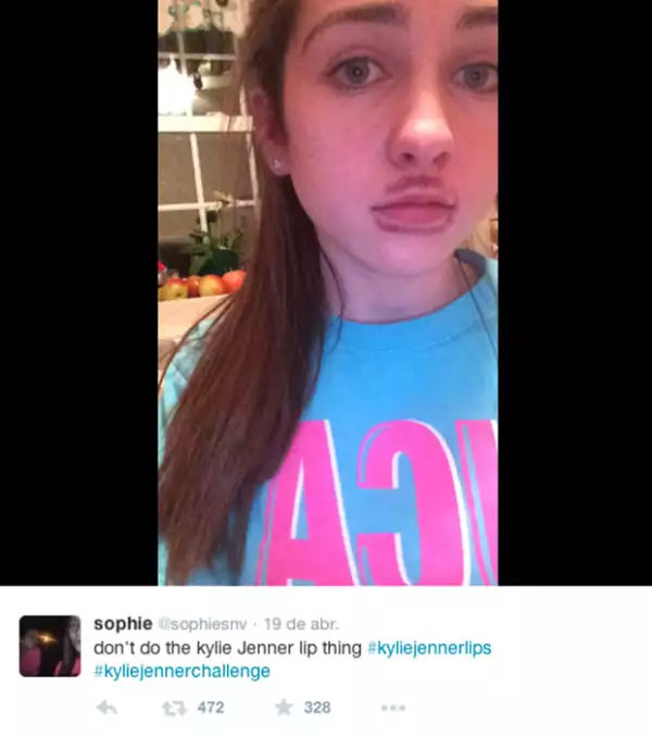 El reto consiste en succionar un vaso provocando que los labios se inflamen.