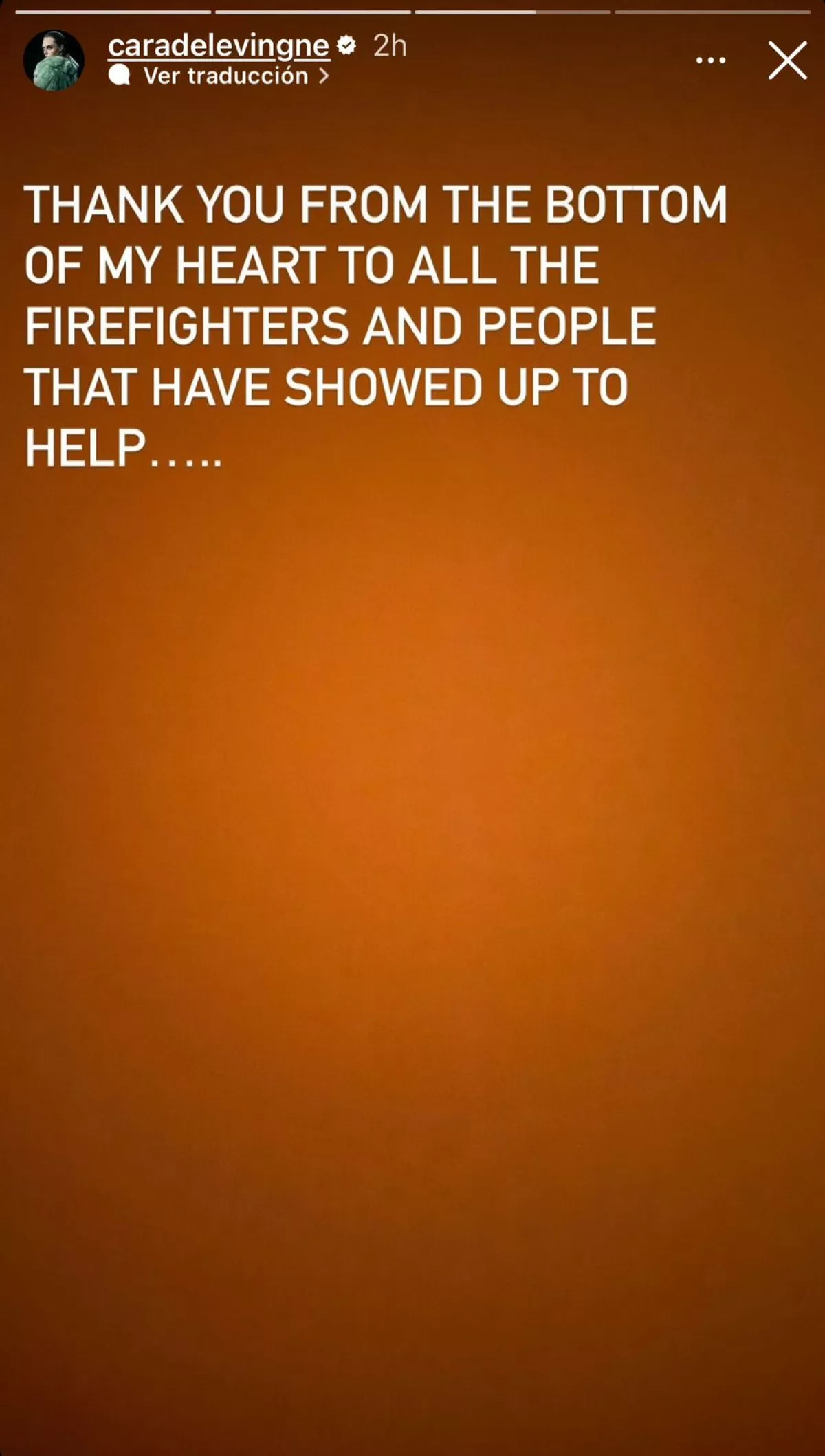 La casa de Cara Delevingne en California queda desecha a causa de un incendio 