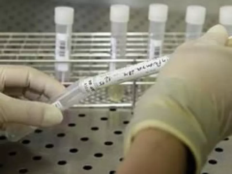Los reportes de contagiados por el virus de la gripe porcina han aumentado. (Foto: Reuters)