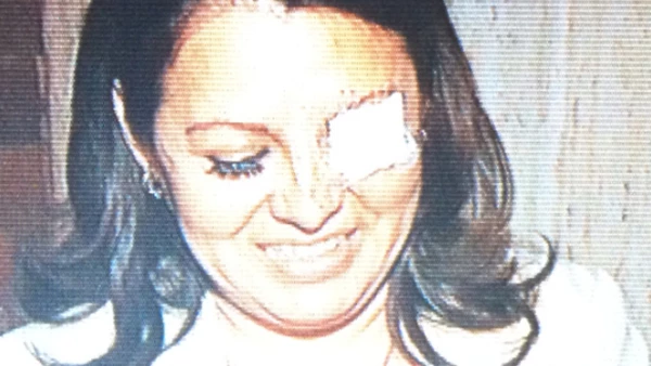 Karen Quiroga, diputada perredista, tuvo un altercado con la diputada Landy Berzunza (en la foto), del PRI, quien tuvo una herida al interior de su ojo tras los arañazos y empujones.