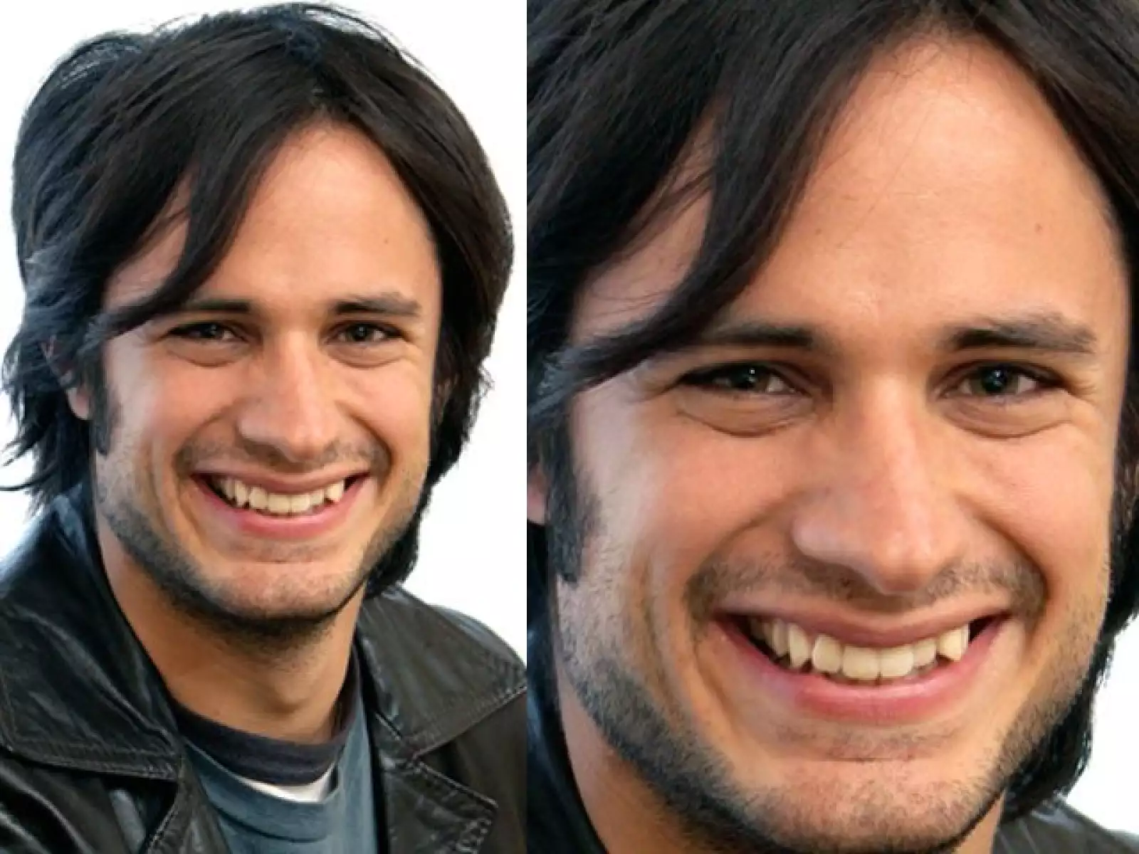 Gael García es asediado por muchas mujeres pues tiene hermosos ojos, es guapo y carismático, pero sus dientes necesitan una ayudadita del dentista.