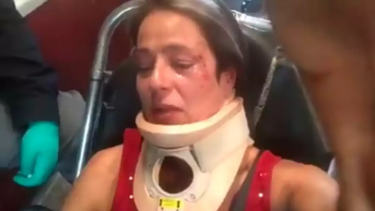 América Gabriel confesó que ya descubrieron la identidad de su agresor, quien la golpeó luego de que ella le pidiera recoger las heces de su perro en Parque México, Condesa.