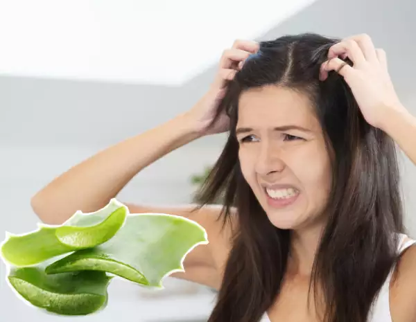 El aloe vera ayuda a calmar irritaciones y comezón del cuero cabelludo.