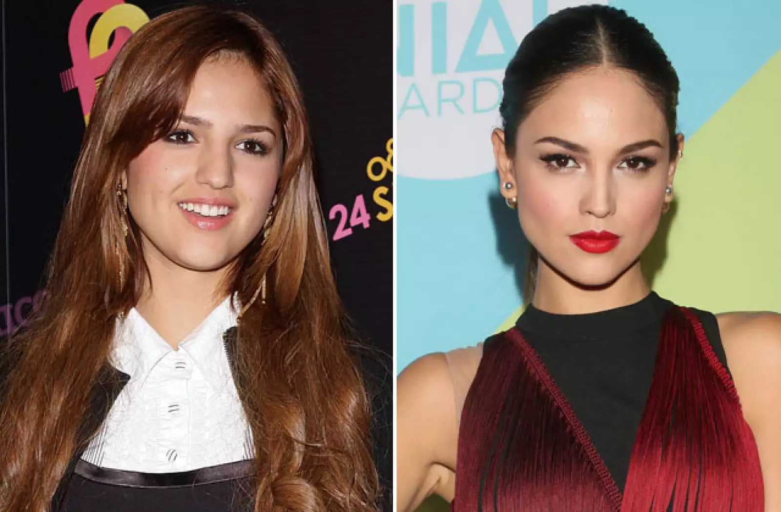 La actriz Eiza González reconoció en 2011 haberse sometido a cirugías para afinar su rostro y aclaró que no usaría pretextos de salud para justificar la intervención, pues todo se debió a un gusto personal.