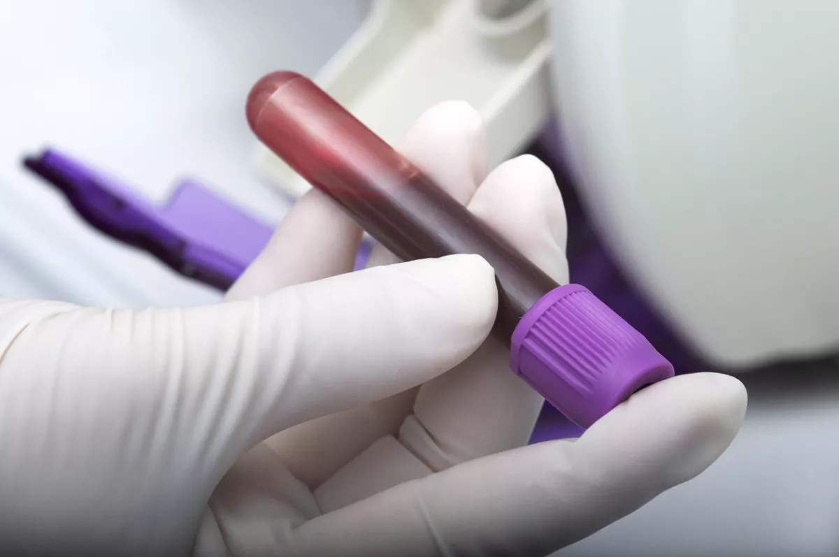 prueba de sangre que detecta más de 50 tipos de cáncer
