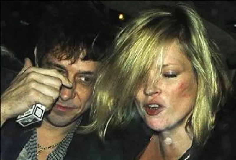 La modelo británica fue captada con su novio en estado de ebriedad y con marcas en la cara.