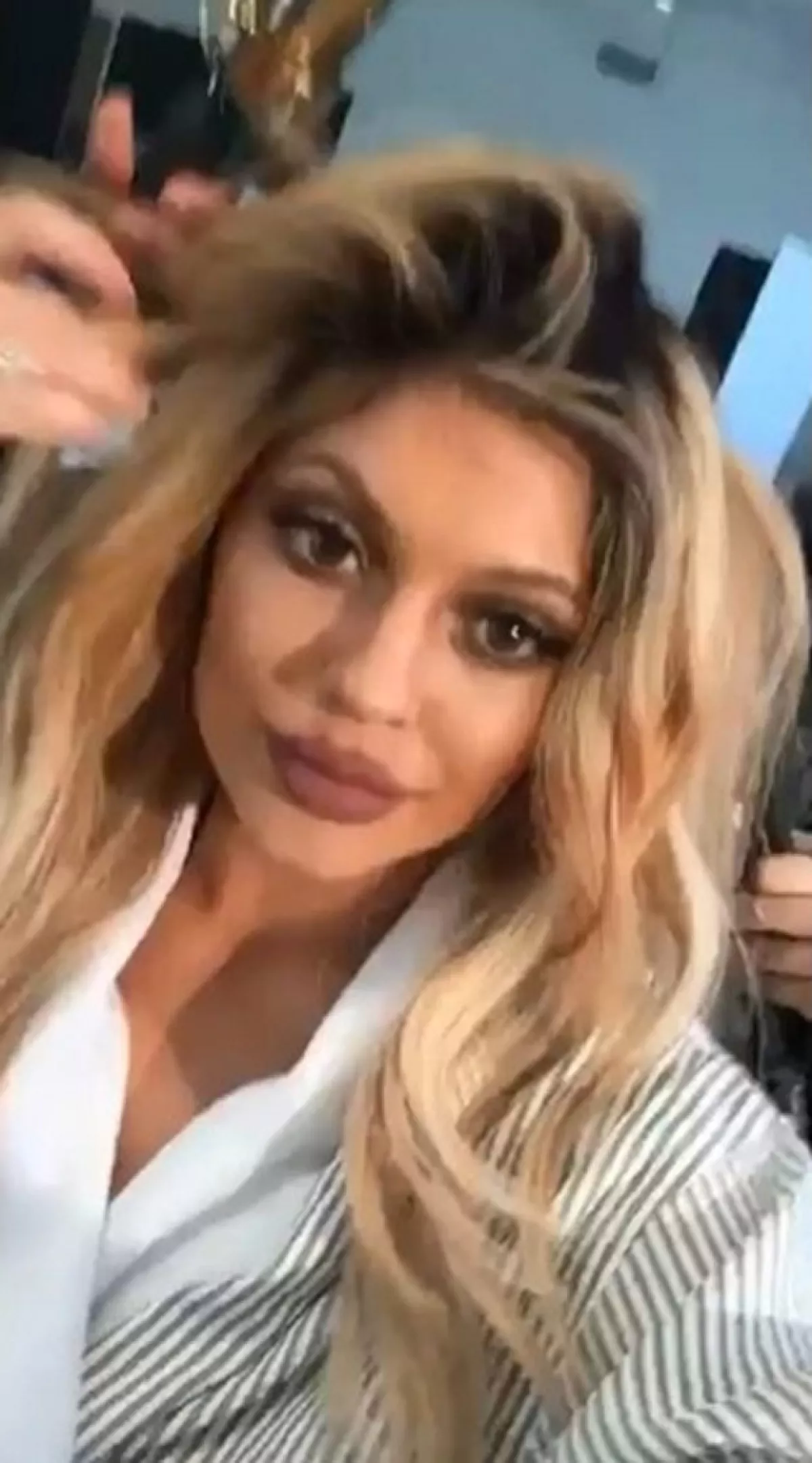 Sus labios vuelven a desatar polémica, pues sus seguidores creen que ya ha llegado muy lejos con sus operaciones.