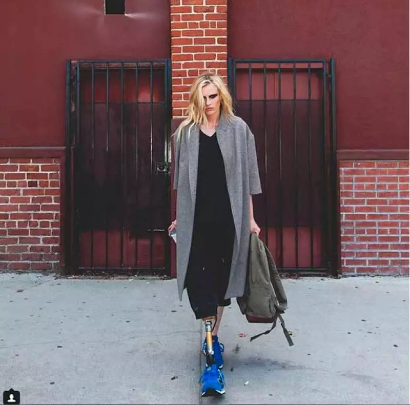 Lauren Wasser, de 27 años, perdió la pierna derecha luego de sufrir síndrome de shock tóxico, producido por el uso de tampones.