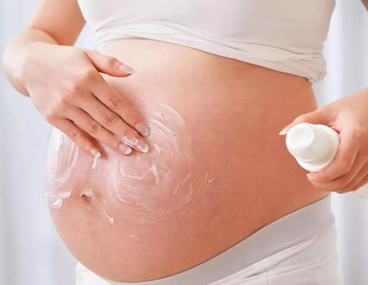 Una de las principales causas de estrías en las mujeres es el embarazo.