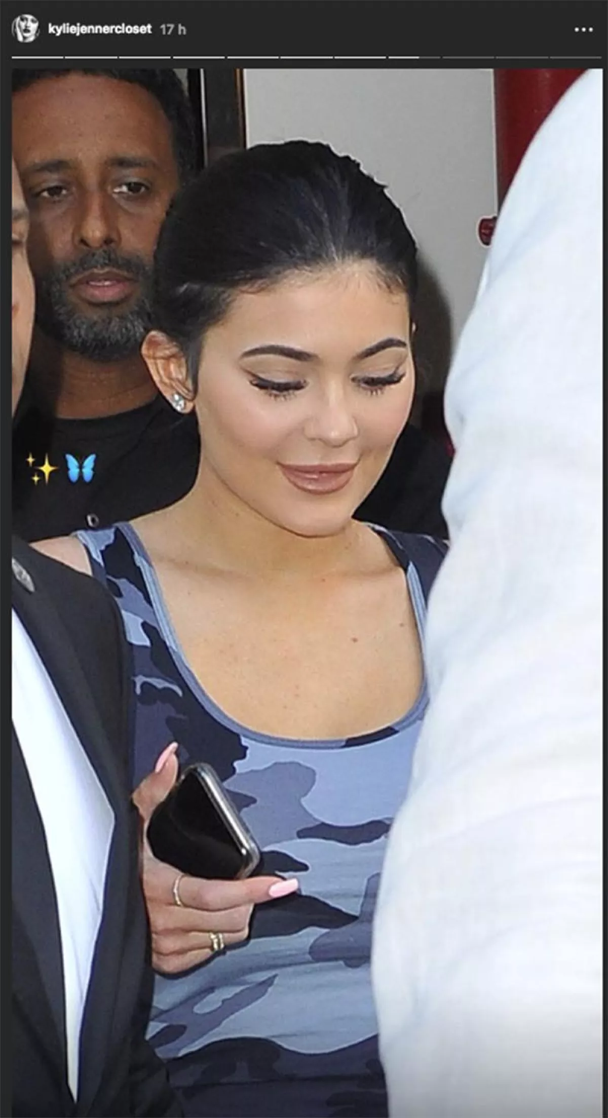 kylie-jenner-relleno-labios