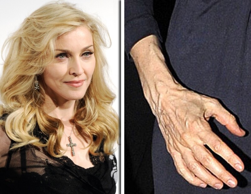 Actualmente la reina del pop usa guantes para ocultar sus manos.