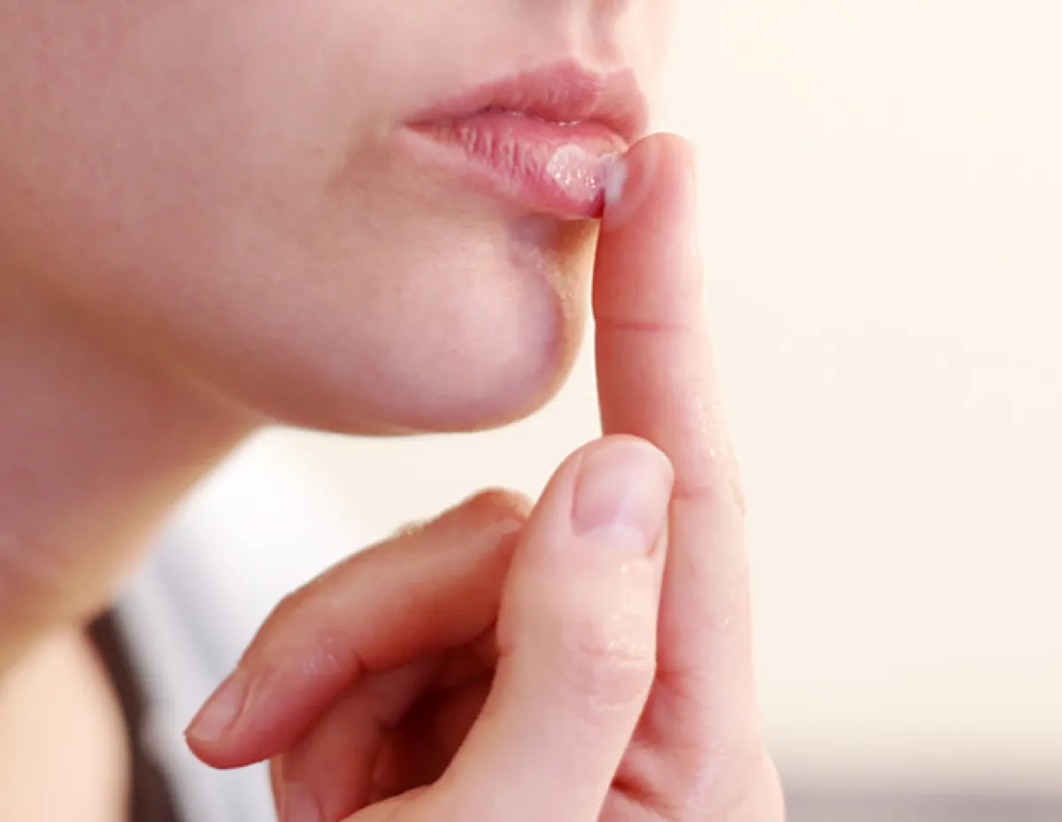 Los labios resecos se ven mal y son molestos. Aplica bálsamo con protector solar para cuidarlos.