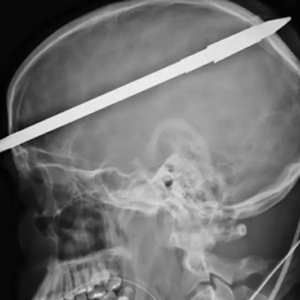 disparo, lanza, sobrevive, 