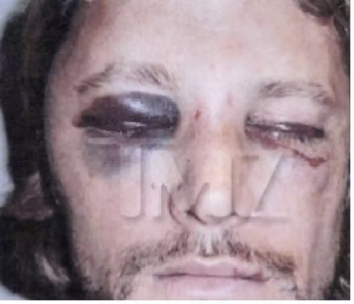 De acuerdo con el portal TMZ, la declaración de Gabriel Aubry, respaldada por fotografías, pinta un cuadro totalmente diferente al que se había difundido luego del pleito.