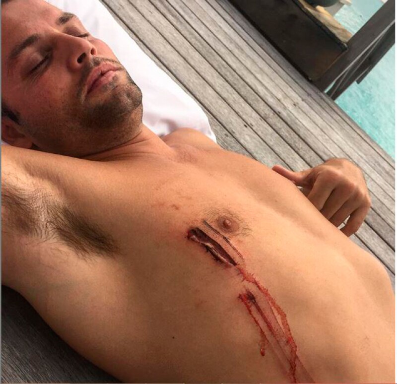 Uno de los amigos del cantante resultó herido por un tiburón.