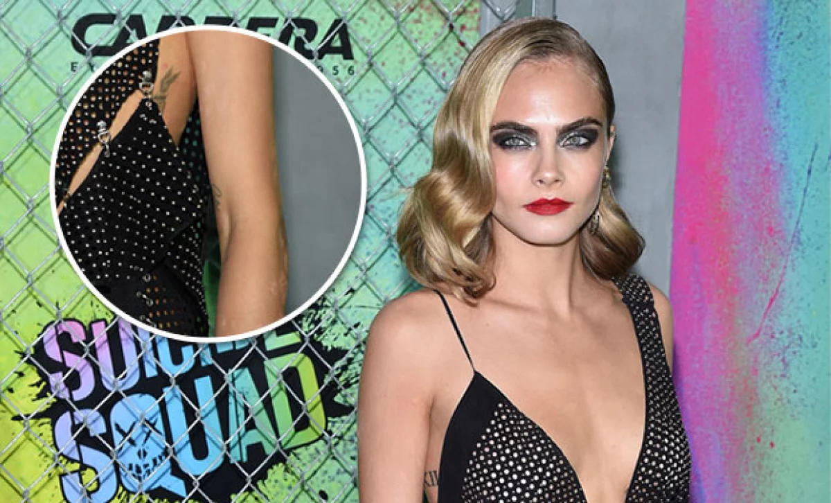 El estrés está acabando con la modelo y actriz, pues durante la premiere de Suicide Squad, su piel se vio muy afectada por psoriasis.