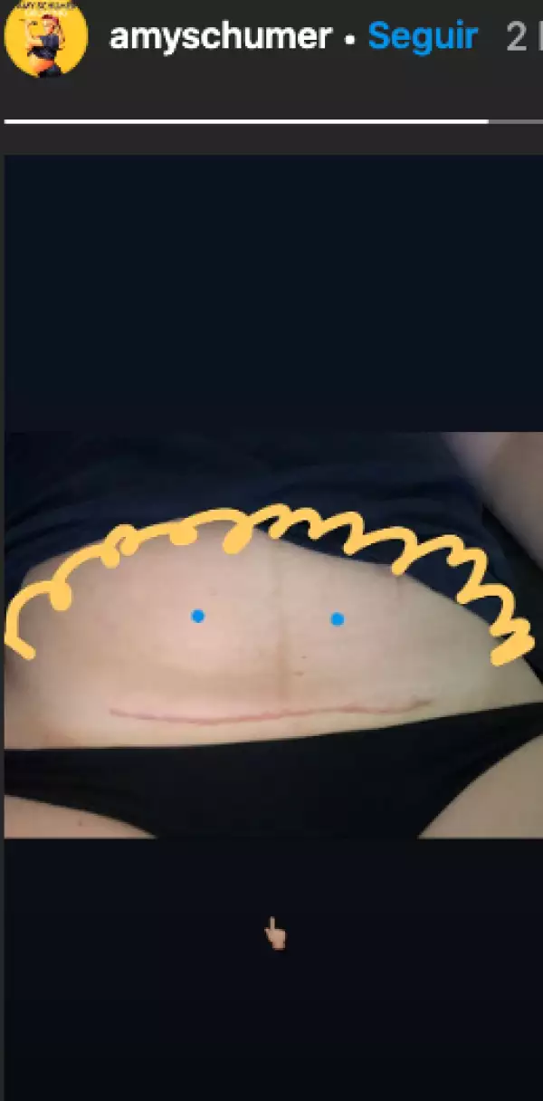 Amy Schumer