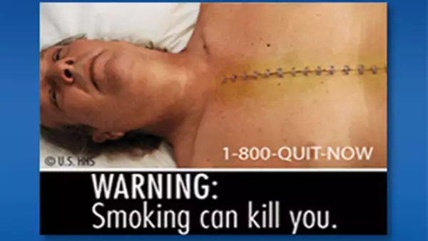 Las imágenes llevan además advertencias como ‘Fumar puede matarle’ y ‘Los cigarrillos causan cáncer’.
