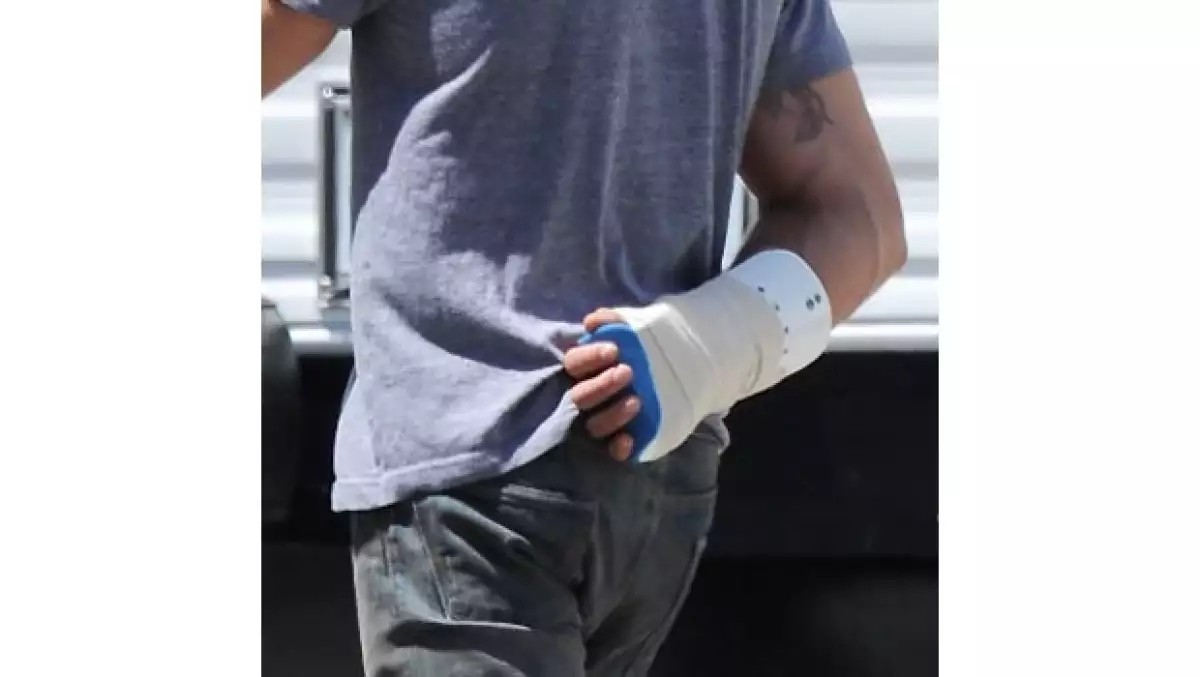 Los accidentes no se hacen esperar en los `sets´ de grabación, y esta vez fue el guapo protagonista de `High School Musical´ quien se lastimó la muñeca durante el rodaje de su próxima película.