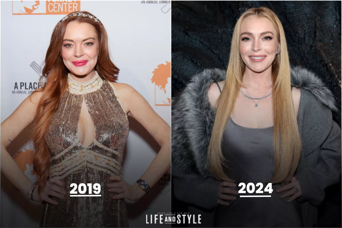 Foto de Lindsay Lohan antes y después de su tratamiento facial: a la izquierda la actriz en 2019 y a la derecha la actriz en 2024.