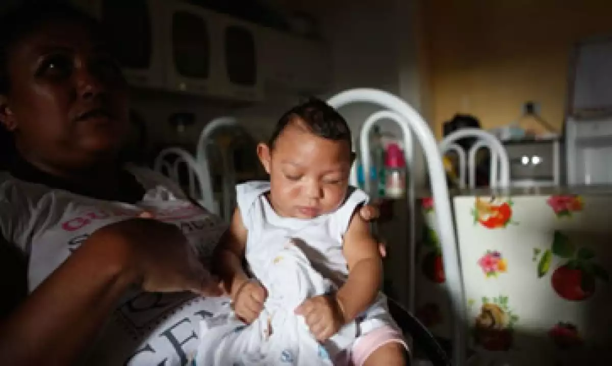 Los CDC dicen que se fortalece la evidencia de la relación del zika con la microcefalia. (Foto: Getty Images)