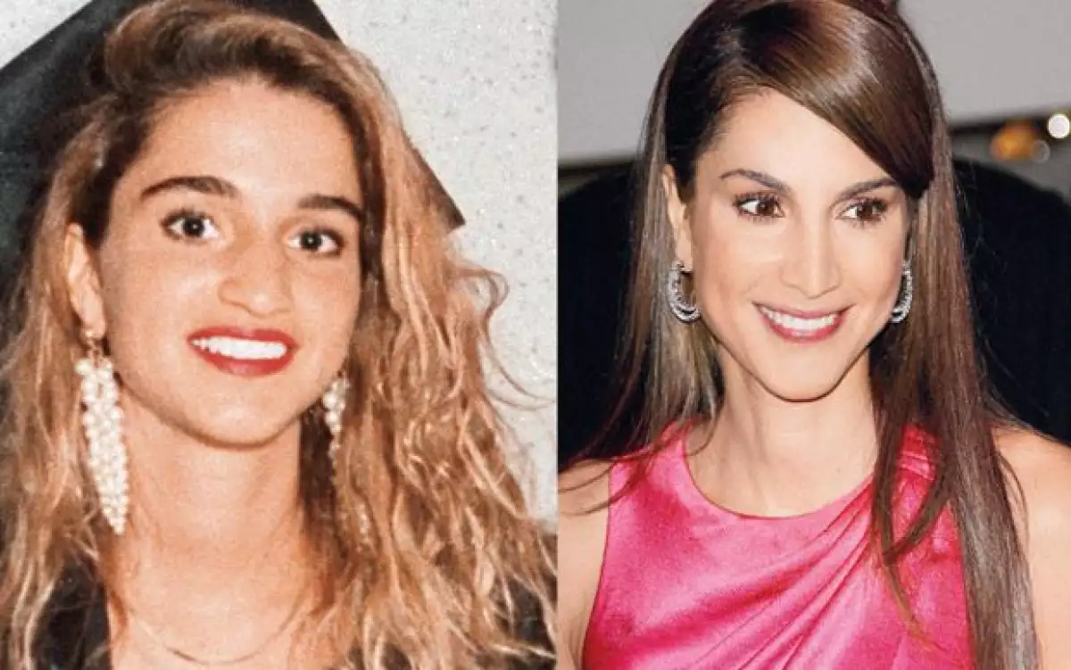 Así lucía la esposa de Abdalá II antes de conocerlo y de operarse la nariz en 1993 (Der). Rania no es la única que ha recurrido a la cirugía: Letizia de España y Silvia de Suecia también son cómplices.